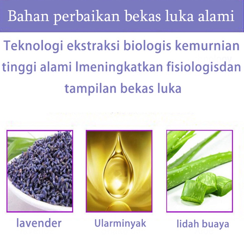 Krim Cream Salep penghilang luka bekas Menghilangkan stretch mark Penghilang bekas luka yang ampuh Memperbaiki bekas luka bakar Bekas Jerawat Bekas luka lama Benjolan dan jerawat