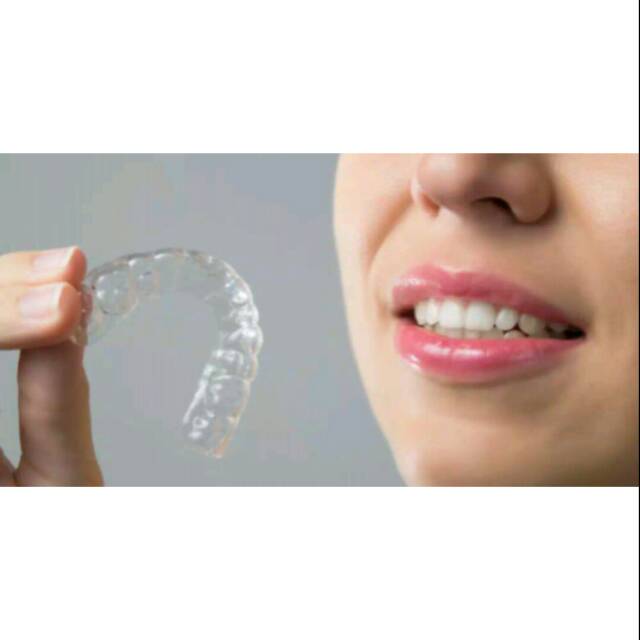 RETAINER GIGI / ESSIX RETAINER