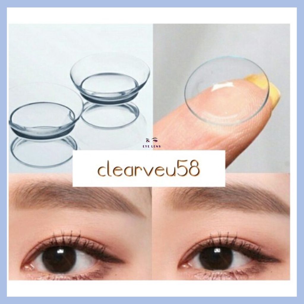 SOFTLENS BENING EXO CLEAR MINUS (5.25 s/d 10.00) / 14.2mm