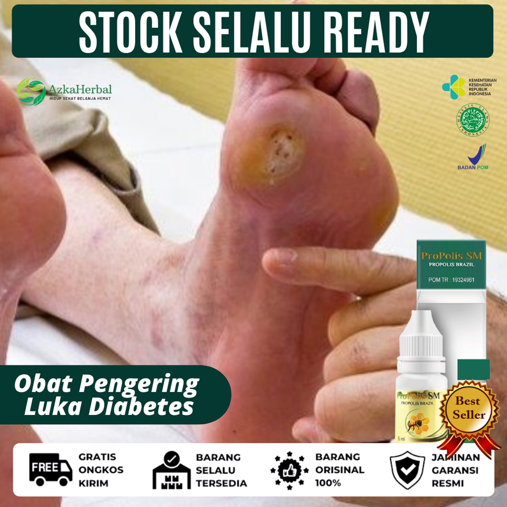 Jual Obat Pengering Luka Diabetes Obat Luka Diabetes Bernanah Luka