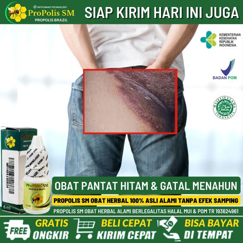 Salep Pantat Burik, Obat Pantat Hitam, Obat Pantat Gatal, Penghilang Pantat Hitam & Gatal, Obat Pant