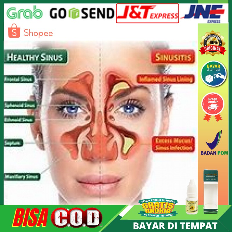 Obat Tetes Herbal Sinusitis Hidung Kronis BPOM Propolis SM Brazillian Original