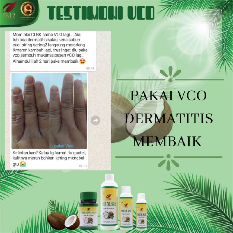 Vco kapsul SR12 Obat penyakit berat Diet paling ampuh Imun booster Minyak kelapa Menaikkan dan Menurunkan Berat Badan Menjaga Daya Tahan Tubuh Melancarkan Persalinan Menyembuhkan luka Berfungsi Sebagai Antivirus Cod BPOM Terlaris Termurah Original