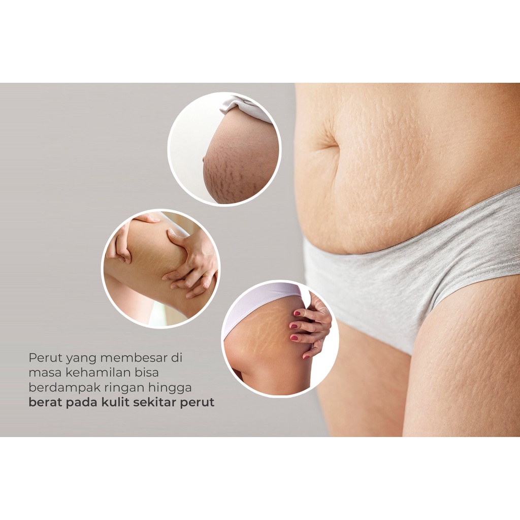 [PROMO] Mooimom Belly Lotion Krim Pelembab Penghilang Stretch Mark 110ml