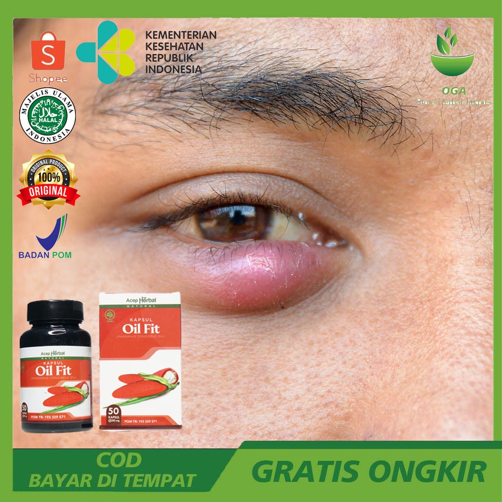 Obat Mata Bintitan Cendo Bengkak Belekan - OIL FIT ASLI BPOM ORIGINAL