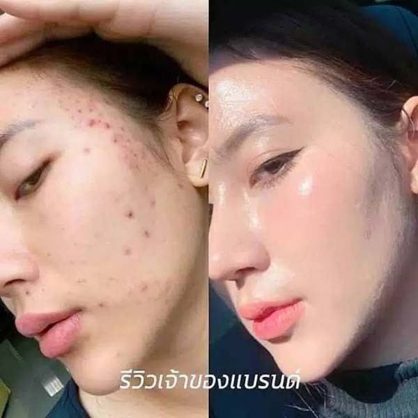 JOJU COLLAGEN update dari CL COLLAGEN  GLUTA PEMUTIH_Lynn Design