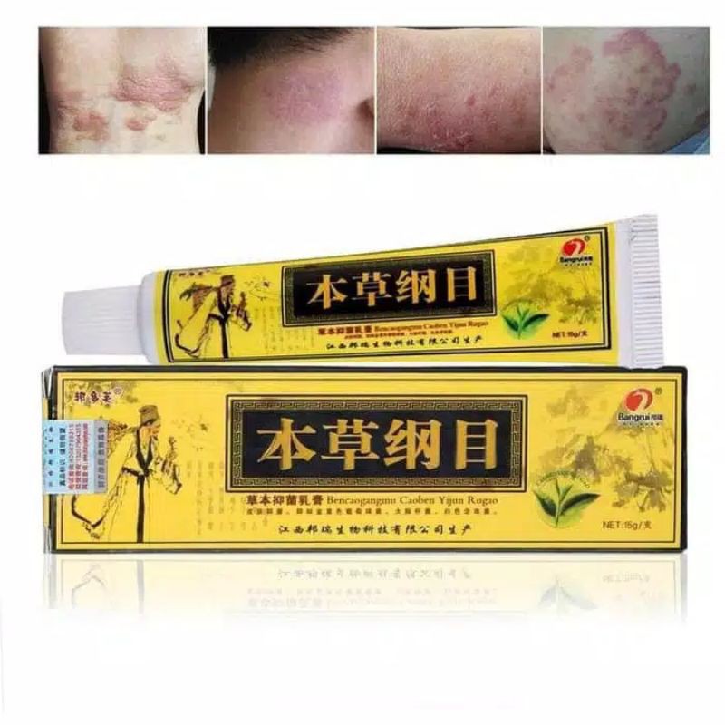 Salep Kuning untuk pengobatan psoriasis dermatitis obat gatal salep kulit gatal kudis jamur