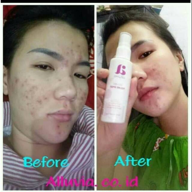 Paket alluvia  glowing