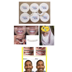 9.9 SALE IDEAL SMILE GIGI PALSU ATAS BAWAH GIGI PALSU INSTAN LEPAS PASANG VENEER GIGI