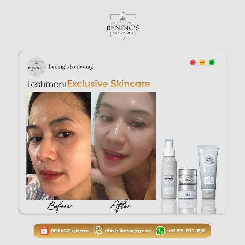 Paket Exclusive shale 25% Khusus Flek Hitam Bening's Skincare By dr.Oky Pratama ~ BENING'S CLINIC Perawatan wajah-3