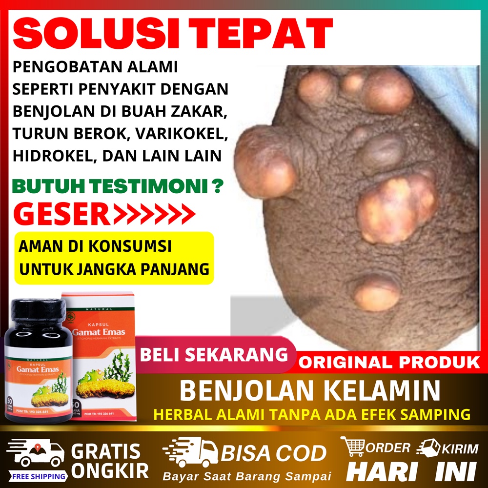 Jual Obat Benjolan di Buah Zakar Pengempis Benjolan Kelamin Biji Buah