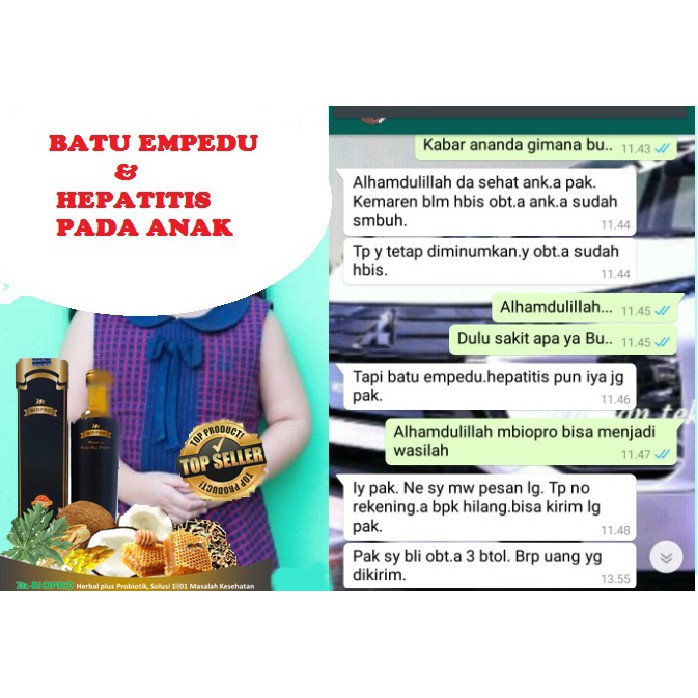 M Biopro Sistem Imun Obat Batu Empedu Kronis-Gallstone-Batu Kolesterol-Batu Pigmen-Batu Ginjal