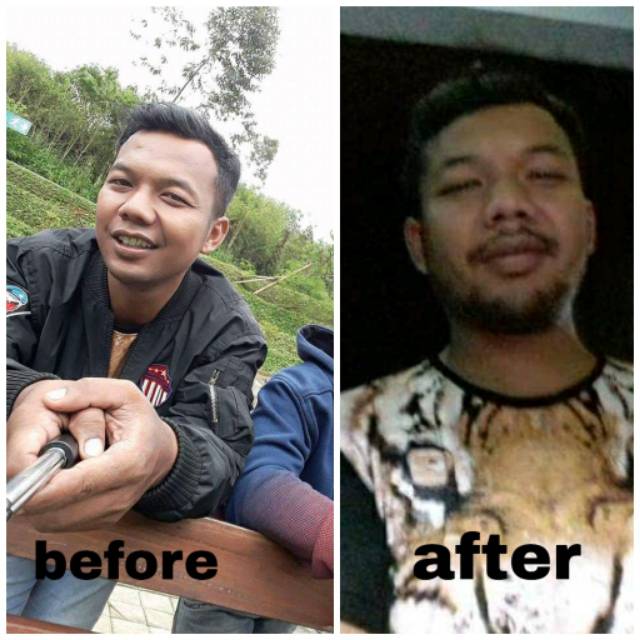 Beard serum obat penumbuh jenggot brewok jambang alis dan rambut