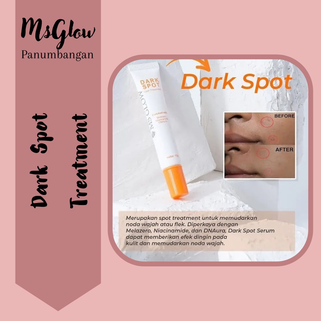 Ms Glow Dark Spot | Memudarkan Flek Hitam