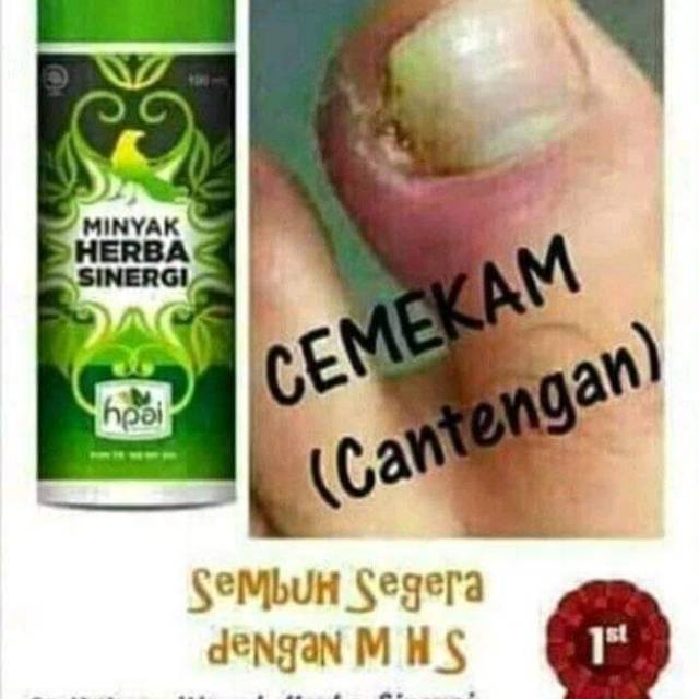 Jual Resep Cantengan Minyak Herba Sinergi Indonesia Shopee Indonesia