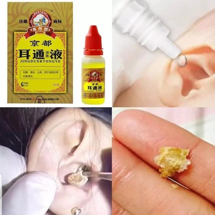 Obat Tetes Telinga Herbal Cina untuk Perawatan Tuli Otitis Tinnitus