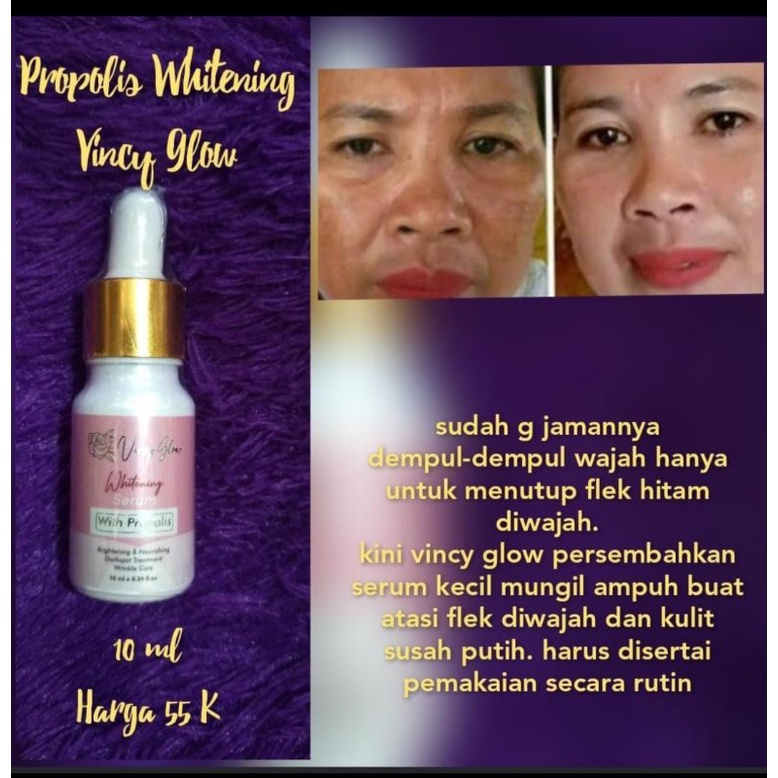 serum propolis vincy