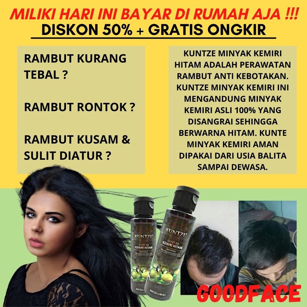 KUNTZE MINYAK KEMIRI HITAM 100ML - MINYAK KEMIRI PENUMBUH RAMBUT MINYAK KEMIRI ASLI 100% ORIGINAL KUNTZE