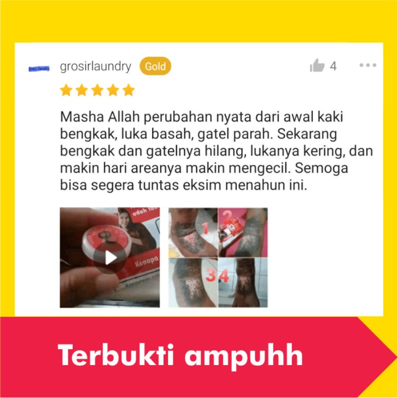 Salep Obat Kurap Kudis Paling Ampuh Gatal Kulit Gatel Kadas Eksim Kering Kutu Air Jamur Selangkangan-3