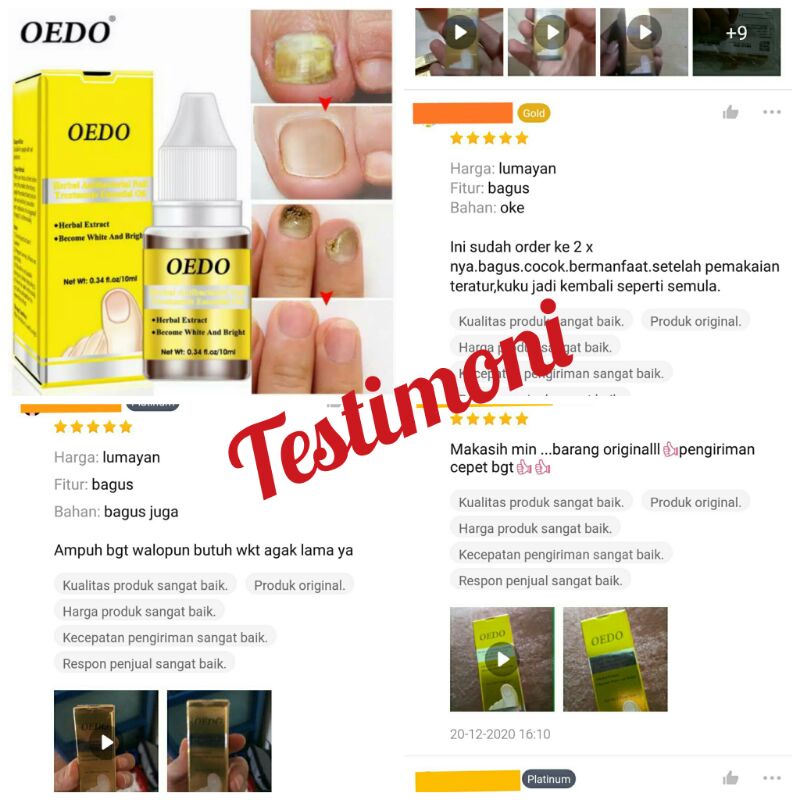 OEDO ESSENTIAL OIL perawatan jamur kuku