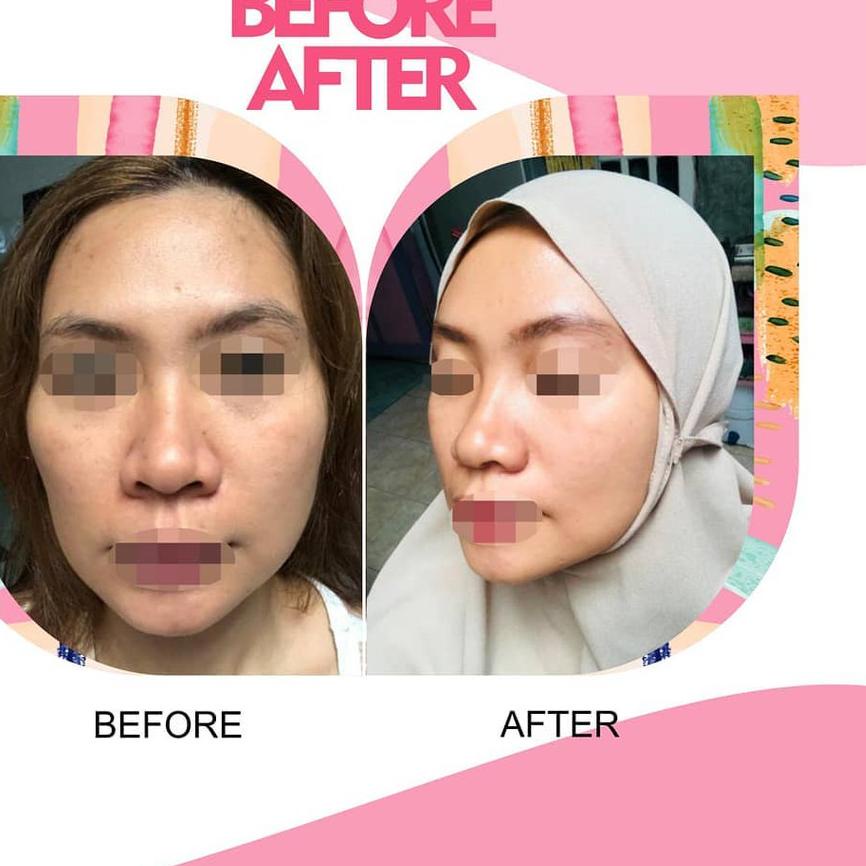 ♛ READY ! Paket Whitening Glafidsya Skin Skincare by Dr Reza Gladys Glafidsya Medika Original BPOM ♪