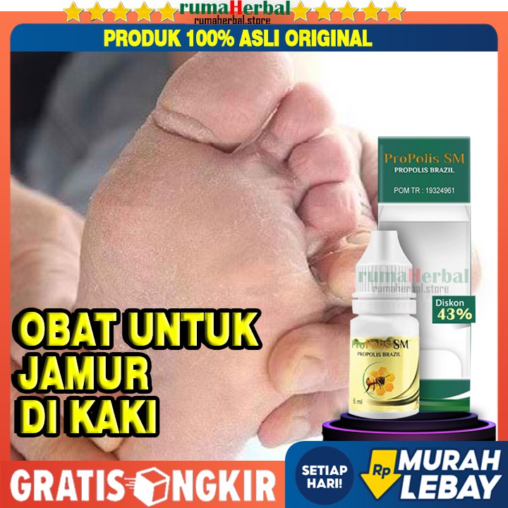 Obat Jamur Kaki Obat Kaki Berlubang Bolong Bolong Rangen Tumit Kasar Kering Salep Kaki Pecah Shopee Indonesia