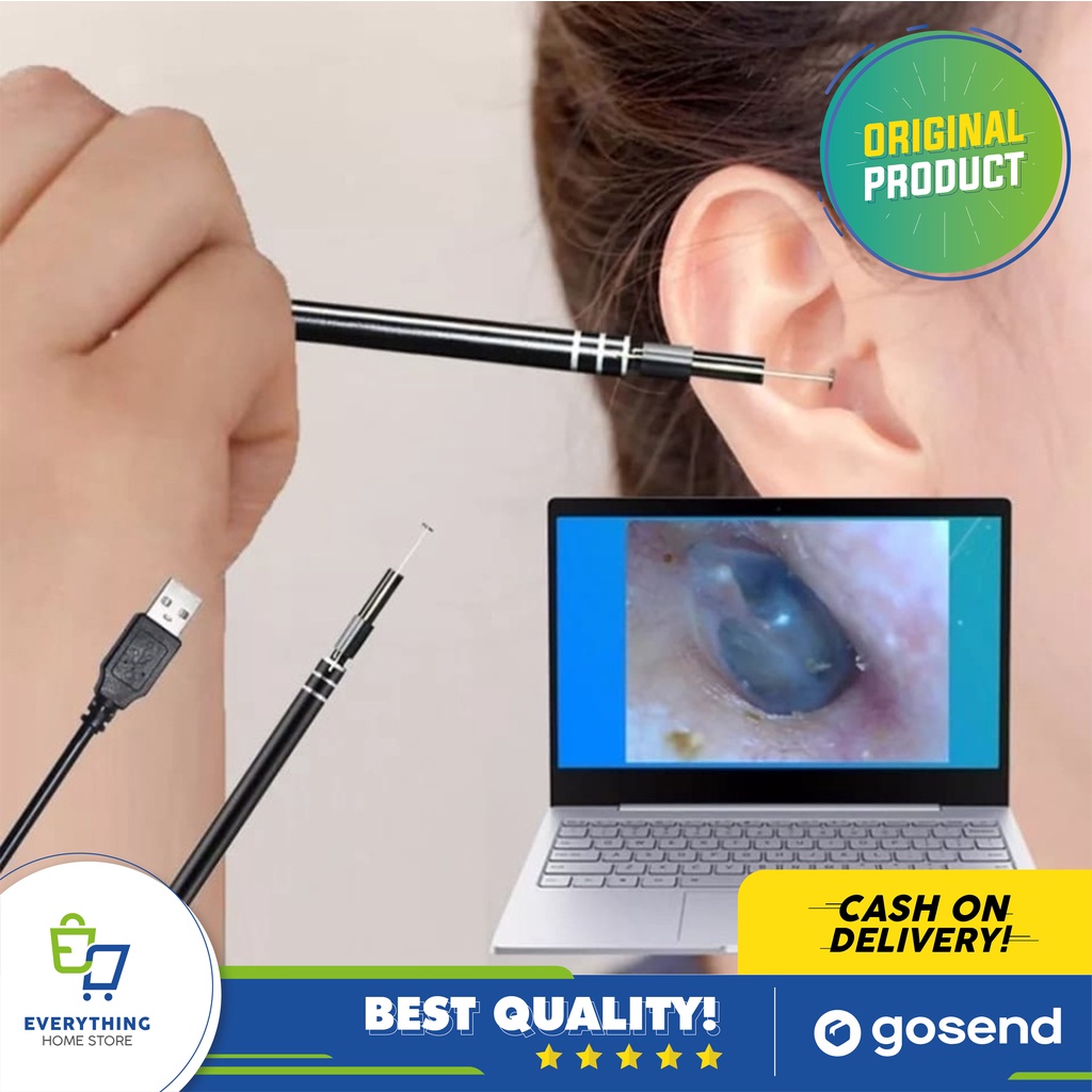 Korek Kuping Anak Dengan Kamera | Korek Kuping Dengan Kamera