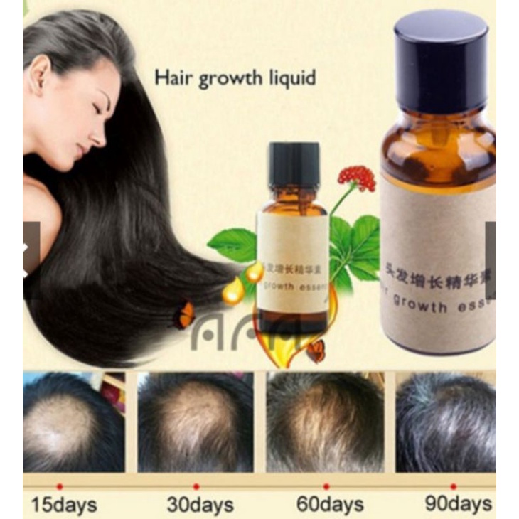 ANDREA SERUM RAMBUT RONTOK TIPIS BOTAK ANDREA GLOWTH HAIR ASSENCE