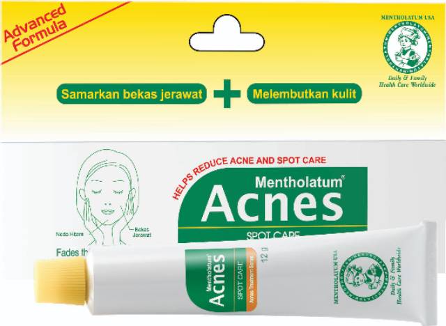 33+ Acnes Spot Care Untuk Bopeng
 PNG