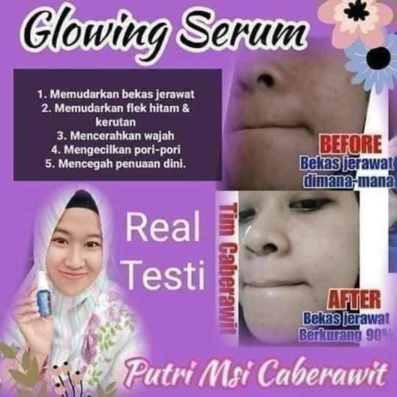 serum glowing MSI