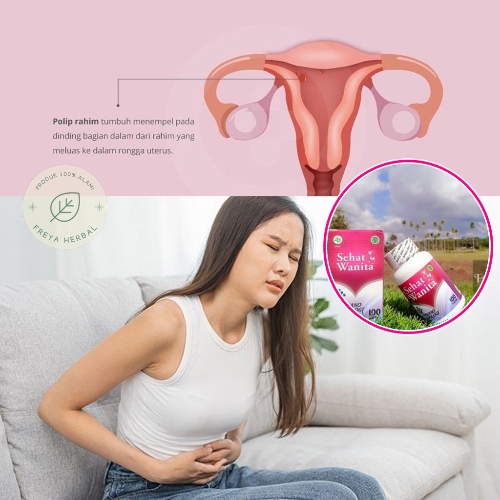 OBAT POLIP RAHIM, OBAT POLIP SERVIKS, OBAT TUMOR JINAK DI RAHIM