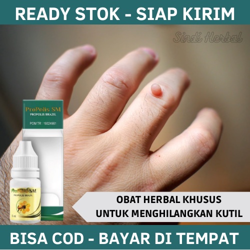 Obat Kutil, Obat kutil Kelamin, Obat kutil Di Leher, Obat kutil Wajah, Obat Kutil Tangan, Obat kutil