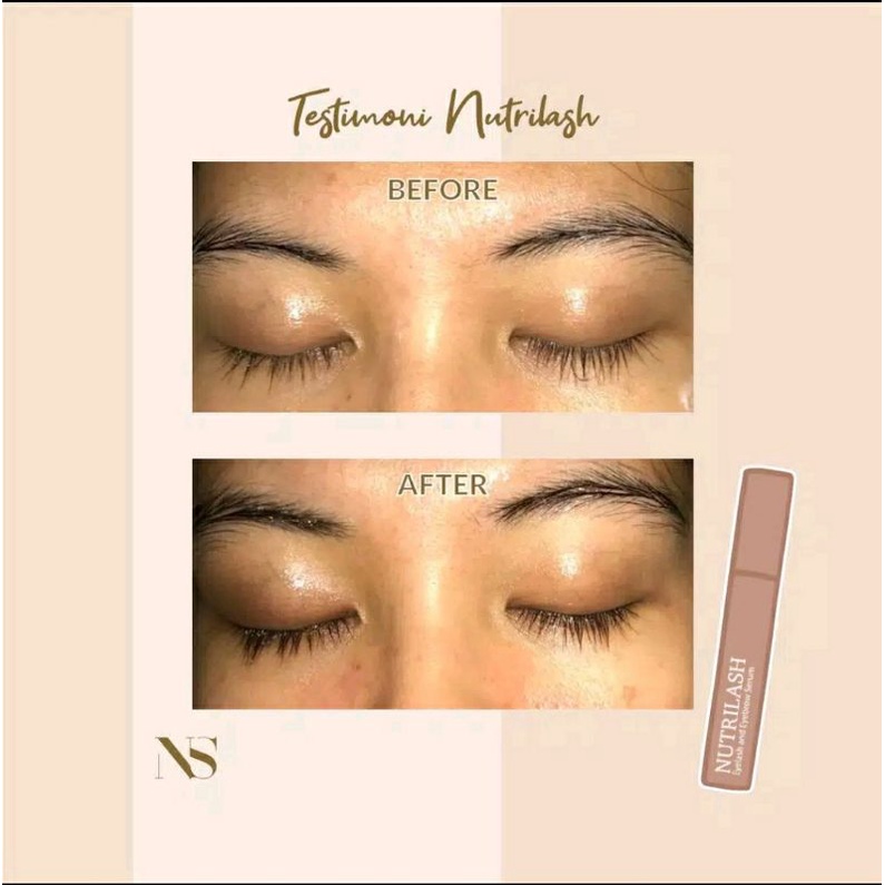 Nutrishe - Nutrilash Eyelash &amp; Brow Serum