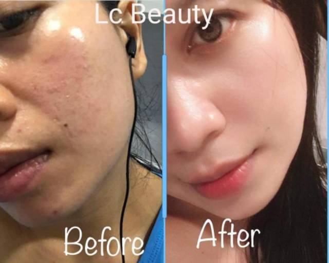 LC BEAUTY ORIGINAL 100%