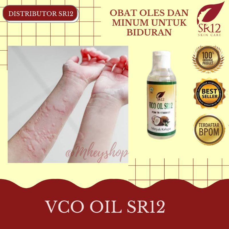 VICO SR12 OBAT BIDURAN UNTUK SEMUA USIA OBAT ALERGI IRITASI DAN GATAL PADA SELURUH TUBUH