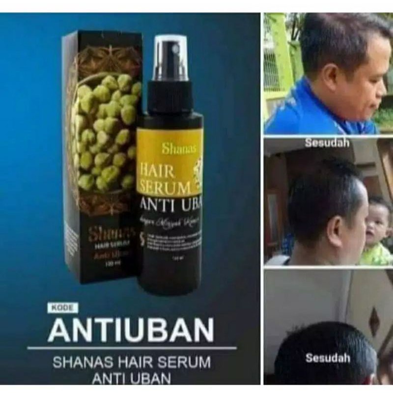 

Anti Uban
