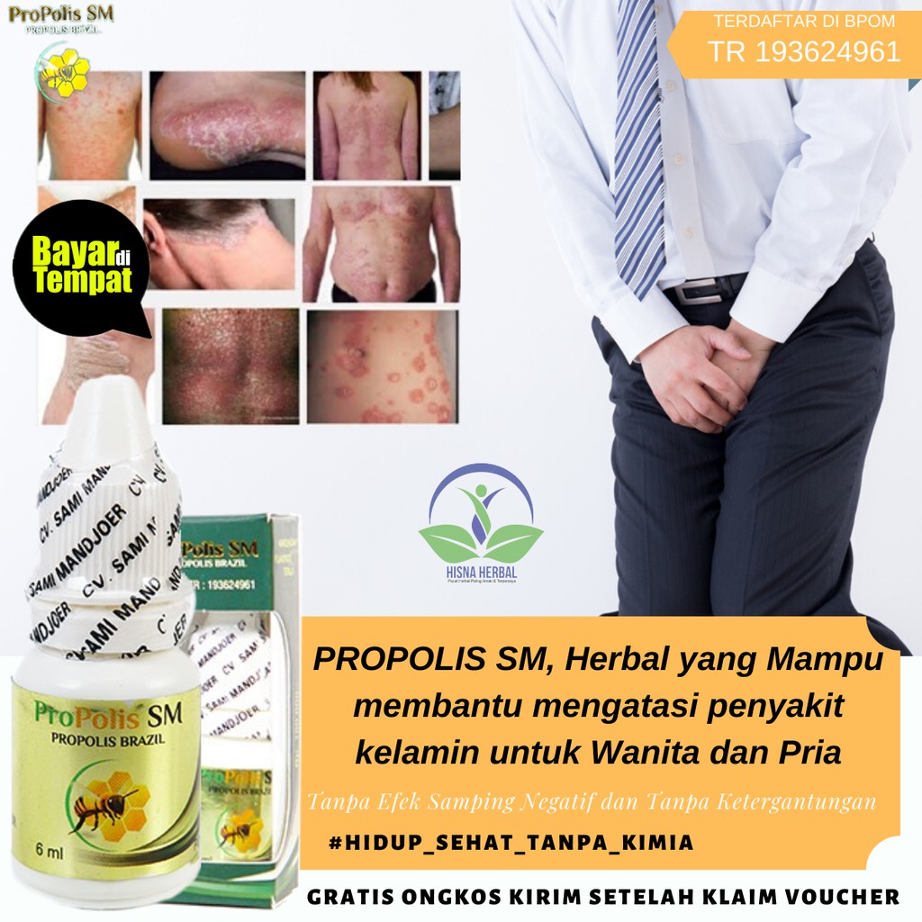 Obat gatal di penis