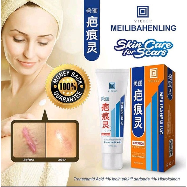 MEILIBAHENLING VICELL CREAM PENGHILANG BEKAS LUKA