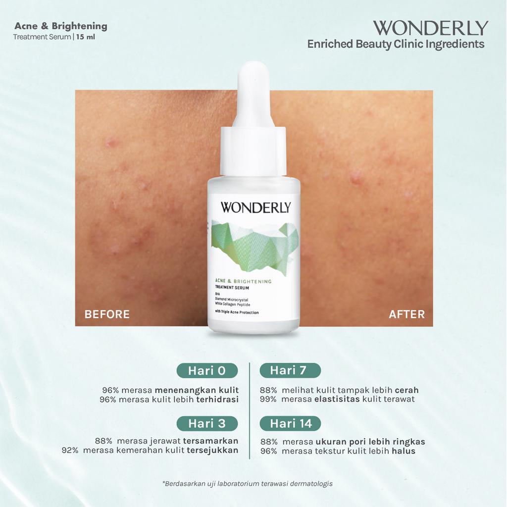 Wonderly Face Serum 15ml // ACNE AND BRIGHTENING TREATMENT SERUM 15 ML - ADVANCED BRIGHTENING FACE SERUM 15 ML