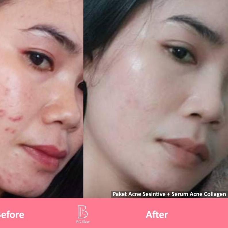 ✦ BG SKINCARE / BEAUTY GLOW skincare ULTIMATE LUXURY /LUXURY/ACNE LUXURY/ BG SKIN GLOW ☚