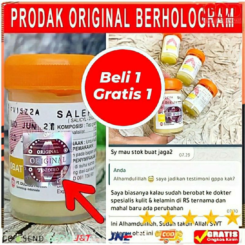 Salep zwafel 24 Obat Salep Gatal Paling Ampuh Gatel Kulit  Kadas Jamur Eksim Kutu Air Jerawat Selangkangan