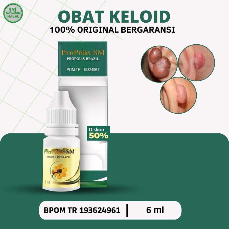 Jual Propolis Sm Obat Keloid Obat Keloid Luka Tindik Obat Keloid