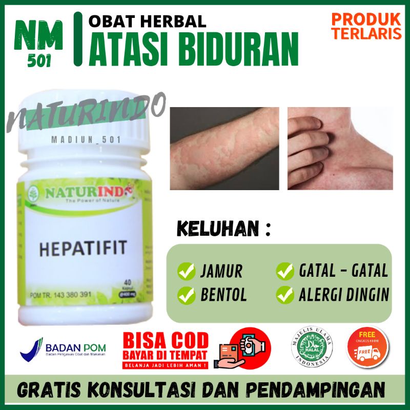 Obat Biduran Gatal Gatal Kulit Alergi Dingin Gatel Ampuh Bintik Merah Bentol Kulit Panu Kurap Kudis 