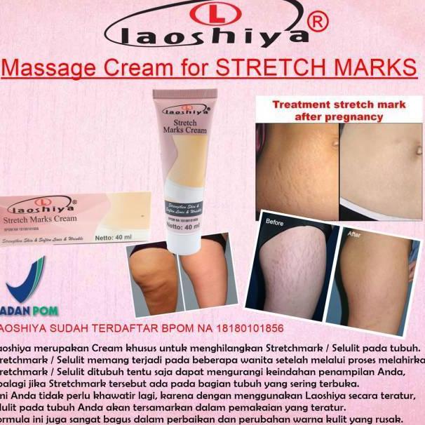 Fresh PENGHILANG STRETCH MARK PALING AMPUH LAOSHIYA STRETCH MARKS CREAM ORIGINAL BPOM .,.,