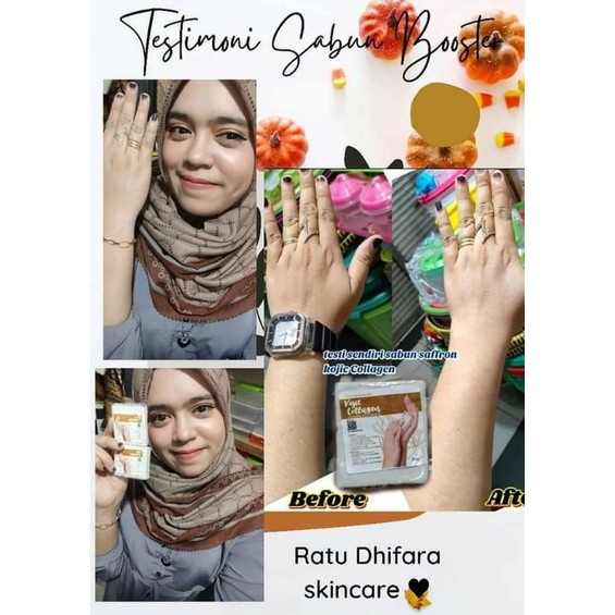 ssbun kojic collagen