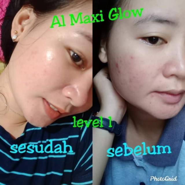 Paket hemat almaxiglow level 3 al maxi glow