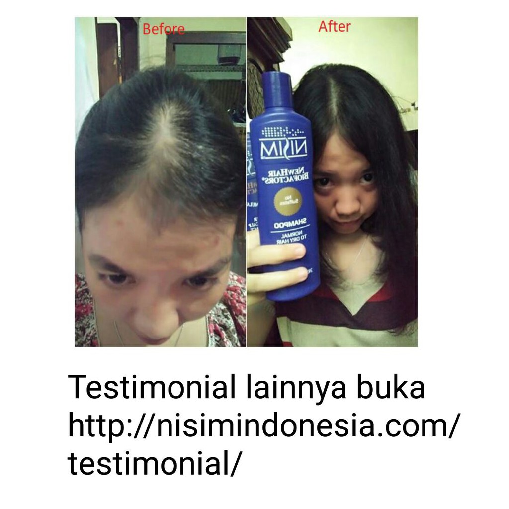 Paket Promo Biofactors Normal Kering