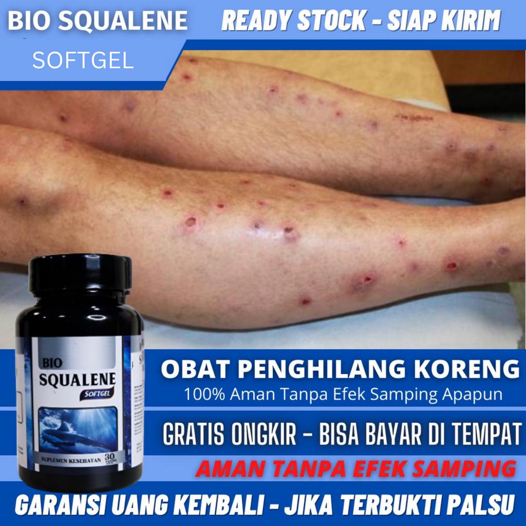 Obat Penghilang Koreng dan Gatal, Korengan, Bekas Koreng, Koreng Bernanah Basah, Koreng Di Kaki Dan 