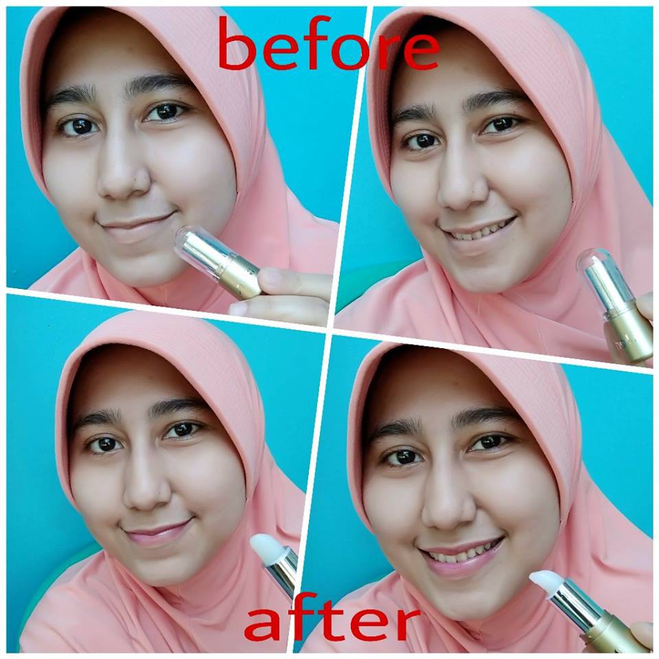 Produk Pemerah Bibir dan Pelembab Bibir Alami untuk memerahkan bibir B Erl Cosmetics Lip Treatment