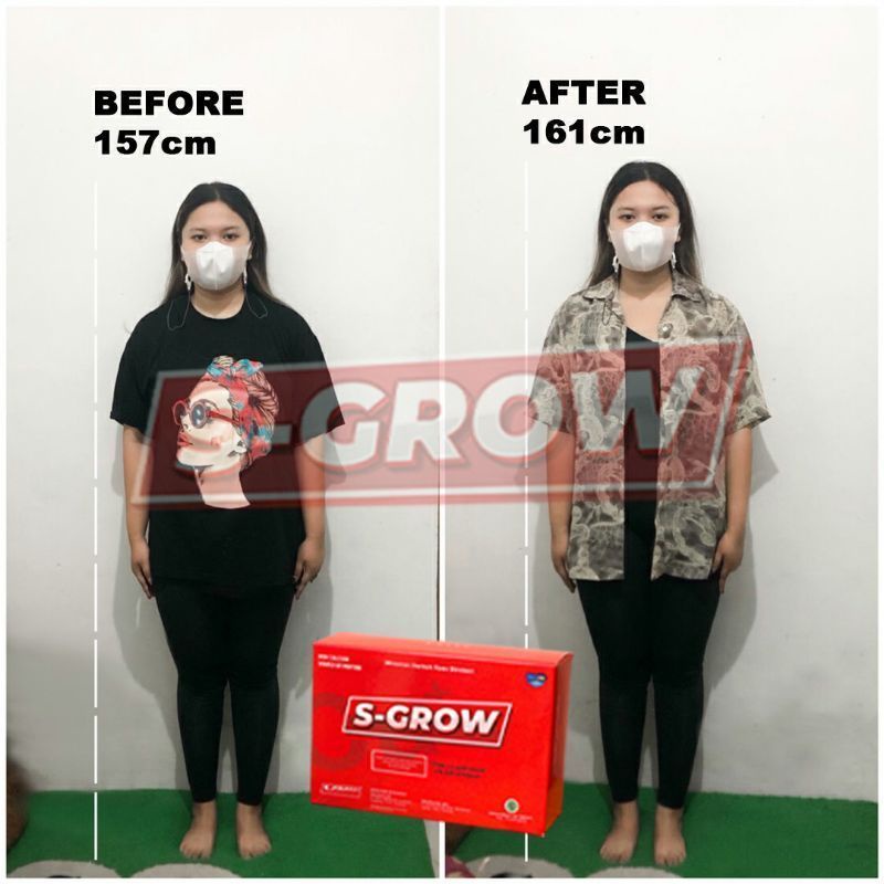 S-GROW Susu Peninggi Badan (Paket Gold 2 Box) Free Skipping